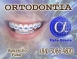 ORTODONTIA ESPECIALIZADA - ALPHA ODONTO DE NATAL - (84) 3081-0021