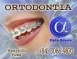 ORTODONTIA ESPECIALIZADA - ALPHA ODONTO DE NATAL - (84) 3081-0021