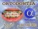 ORTODONTIA ESPECIALIZADA - ALPHA ODONTO DE NATAL - (84) 3081-0021