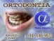 ORTODONTIA ESPECIALIZADA - ALPHA ODONTO DE NATAL - (84) 3081-0021