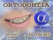 ORTODONTIA ESPECIALIZADA - ALPHA ODONTO DE NATAL - (84) 3081-0021