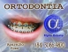 ORTODONTIA ESPECIALIZADA - ALPHA ODONTO DE NATAL - (84) 3081-0021