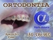 ORTODONTIA ESPECIALIZADA - ALPHA ODONTO DE NATAL - (84) 3081-0021