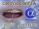 ORTODONTIA ESPECIALIZADA - ALPHA ODONTO DE NATAL - (84) 3081-0021