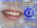 ORTODONTIA EST�TICA - ALPHA ODONTO DE NATAL - (84) 3081-0021