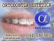 ORTODONTIA EST�TICA - ALPHA ODONTO DE NATAL - (84) 3081-0021
