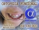 ORTOPEDIA FACIAL - ALPHA ODONTO DE NATAL - (84) 3081-0021