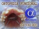 ORTOPEDIA FACIAL - ALPHA ODONTO DE NATAL - (84) 3081-0021