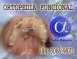 ORTOPEDIA FACIAL - ALPHA ODONTO DE NATAL - (84) 3081-0021