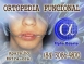 ORTOPEDIA FACIAL - ALPHA ODONTO DE NATAL - (84) 3081-0021